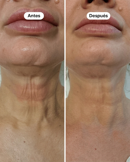 Serum Reafirmante de Cuello